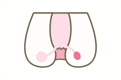 肛門周囲膿瘍